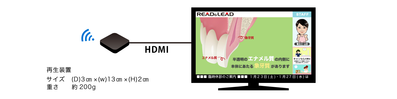 再生装置